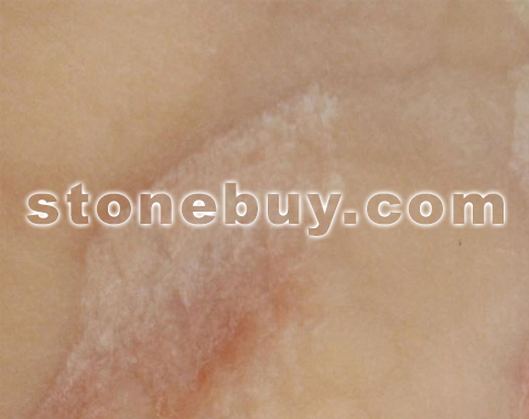 ׻ʯ, Cream Onyx